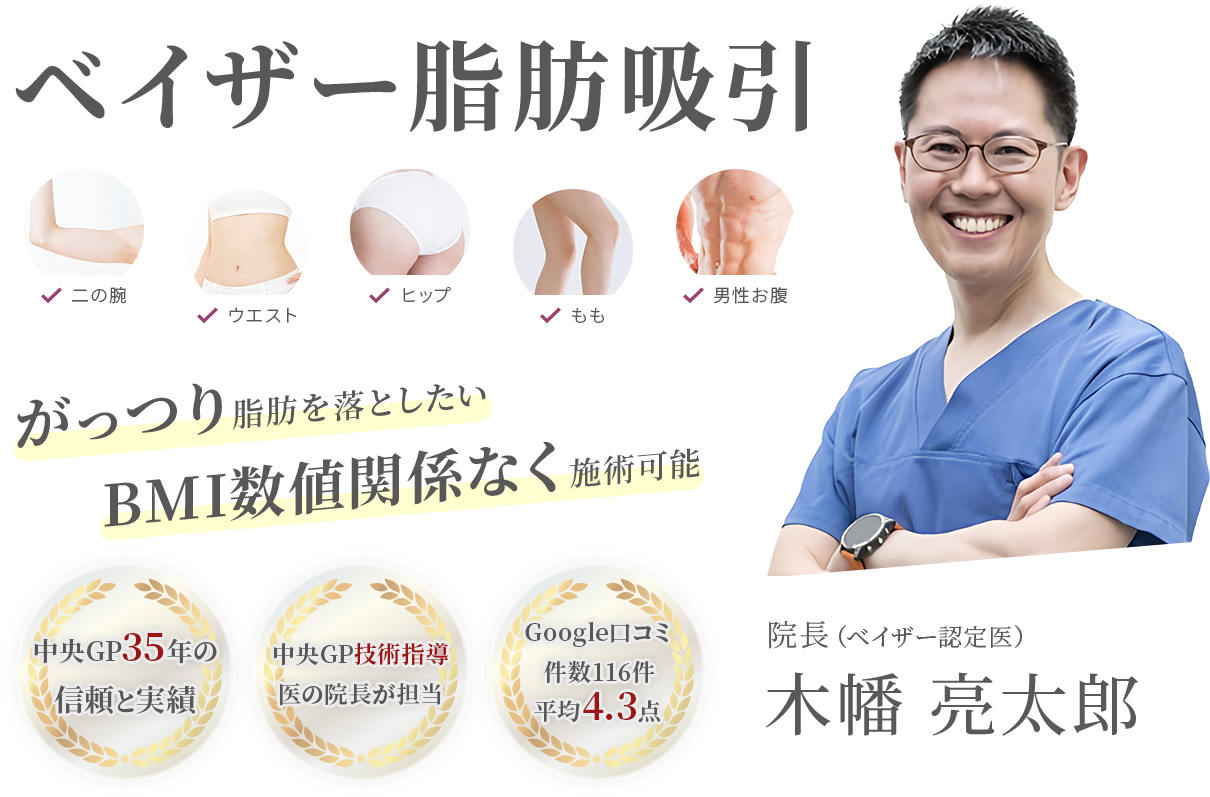 ベイザー脂肪吸引