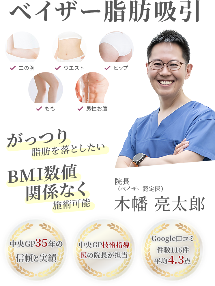 ベイザー脂肪吸引